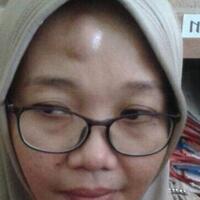 wajah-guru-perempuan-ini-muncul-benjolan-setelah-diamuk-muridnya-yang-tak-naik-kelas