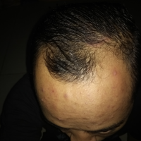 post-image