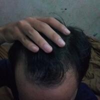 post-image