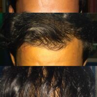 post-image