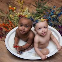 bayi-kembar-ini-lahir-dengan-warna-kulit-berbeda