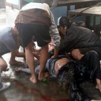 darah-berceceran-di-tkp-ledakan-tabung-gas-tukang-balon-di-cipondoh