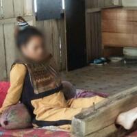 jago-ngaji-dan-peraih-beasiswa-tapi-nasib-jumiati-kini-malah-dipasung