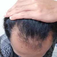 reborn-help-rambut-gua-rontok-hampir-botak