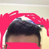 reborn-help-rambut-gua-rontok-hampir-botak