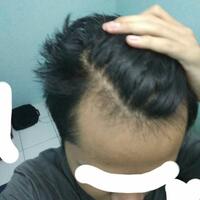 reborn-help-rambut-gua-rontok-hampir-botak