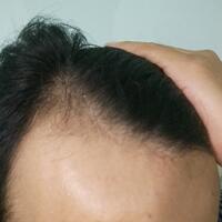 reborn-help-rambut-gua-rontok-hampir-botak