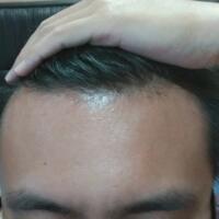 reborn-help-rambut-gua-rontok-hampir-botak