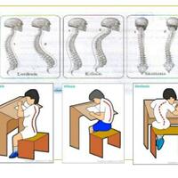 teknologi-pencegah-epidemi-pembungkukan-tulang