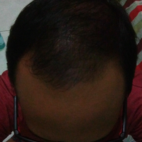 reborn-help-rambut-gua-rontok-hampir-botak