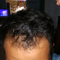 reborn-help-rambut-gua-rontok-hampir-botak