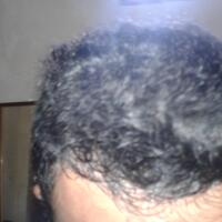 reborn-help-rambut-gua-rontok-hampir-botak