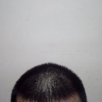 reborn-help-rambut-gua-rontok-hampir-botak