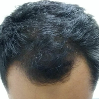 reborn-help-rambut-gua-rontok-hampir-botak