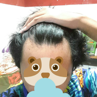 reborn-help-rambut-gua-rontok-hampir-botak