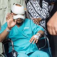 mata-kanan-novel-baswedan-membaik