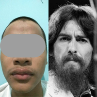 group-brewok-quotbrengozerquot-forum-resmi-berbagi-informasi-progress-hair-facial---part-1