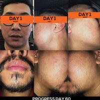 group-brewok-quotbrengozerquot-forum-resmi-berbagi-informasi-progress-hair-facial---part-1