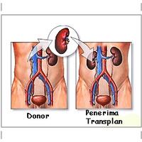 kisah-haru-operasi-transplantasi-ginjal-ibu--berikan-ginjal-terbaik-saya