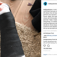 alami-kecelakaan-ed-sheeran-batalkan-konser-di-asia