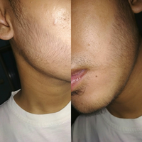 group-brewok-quotbrengozerquot-forum-resmi-berbagi-informasi-progress-hair-facial---part-1