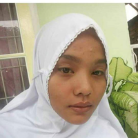 siswi-cantik-ini-alami-penganiayaan-wajah-disayat-sayat-hingga-dibuang-ke-kebun