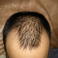 reborn-help-rambut-gua-rontok-hampir-botak