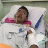 anggi-dirawat-satu-kakak-tak-selamat