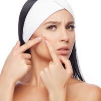 tujuh-mitos-jerawat-yang-tidak-perlu-dipercaya