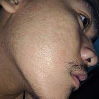 group-brewok-quotbrengozerquot-forum-resmi-berbagi-informasi-progress-hair-facial---part-1