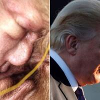guratan-telinga-anjing-ini-mirip-presiden-amerika-donald-trump