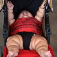 baru-berumur-10-bulan-berat-balita-ini-sudah-capai-28-kg