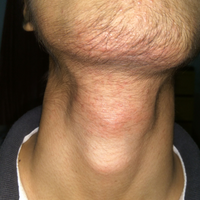 post-image