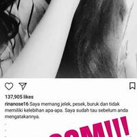 disebut-artis-jelek--pesek-oleh-ust-abdul-somad-rina-nose-curhat-di-instagram