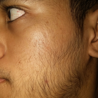 group-brewok-quotbrengozerquot-forum-resmi-berbagi-informasi-progress-hair-facial---part-1