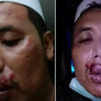 habib-novel-benarkan-ketua-fpi-dipukuli-usai-ceramah-pki