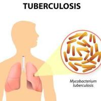 hbd2forsis-kenapa-sih-sista-mesti-peduli-tuberkulosis