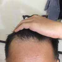 post-image