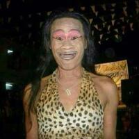 kabar-gadis-operasi-plastik-bak-angelina-jolie-ternyata-palsu