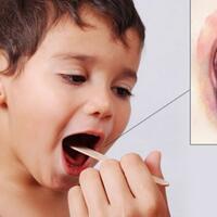 murid-kelas-5-sd-meninggal-sebelumnya-alami-tanda-tanda-menderita-difteri