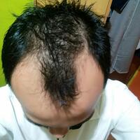 reborn-help-rambut-gua-rontok-hampir-botak