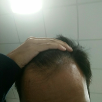 reborn-help-rambut-gua-rontok-hampir-botak