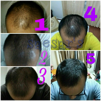 reborn-help-rambut-gua-rontok-hampir-botak