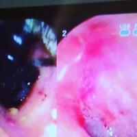 ribuan-lebah-mengejar-dan-menyerang-darmiyati-salah-satunya-masuk-ke-dalam-kuping