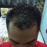 reborn-help-rambut-gua-rontok-hampir-botak