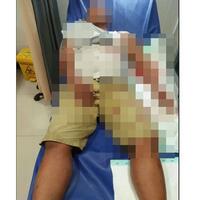 ke-surabaya-ingin-menagih-uangnya-kembali-pria-bangkalan-malah-dibacok-celurit