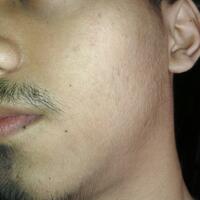 group-brewok-quotbrengozerquot-forum-resmi-berbagi-informasi-progress-hair-facial---part-1