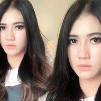 via-vallen-bermasalah-dengan-pipi-tembem-netizen-bilang-tetap-bikin-gemas