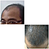 reborn-help-rambut-gua-rontok-hampir-botak