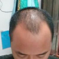 reborn-help-rambut-gua-rontok-hampir-botak